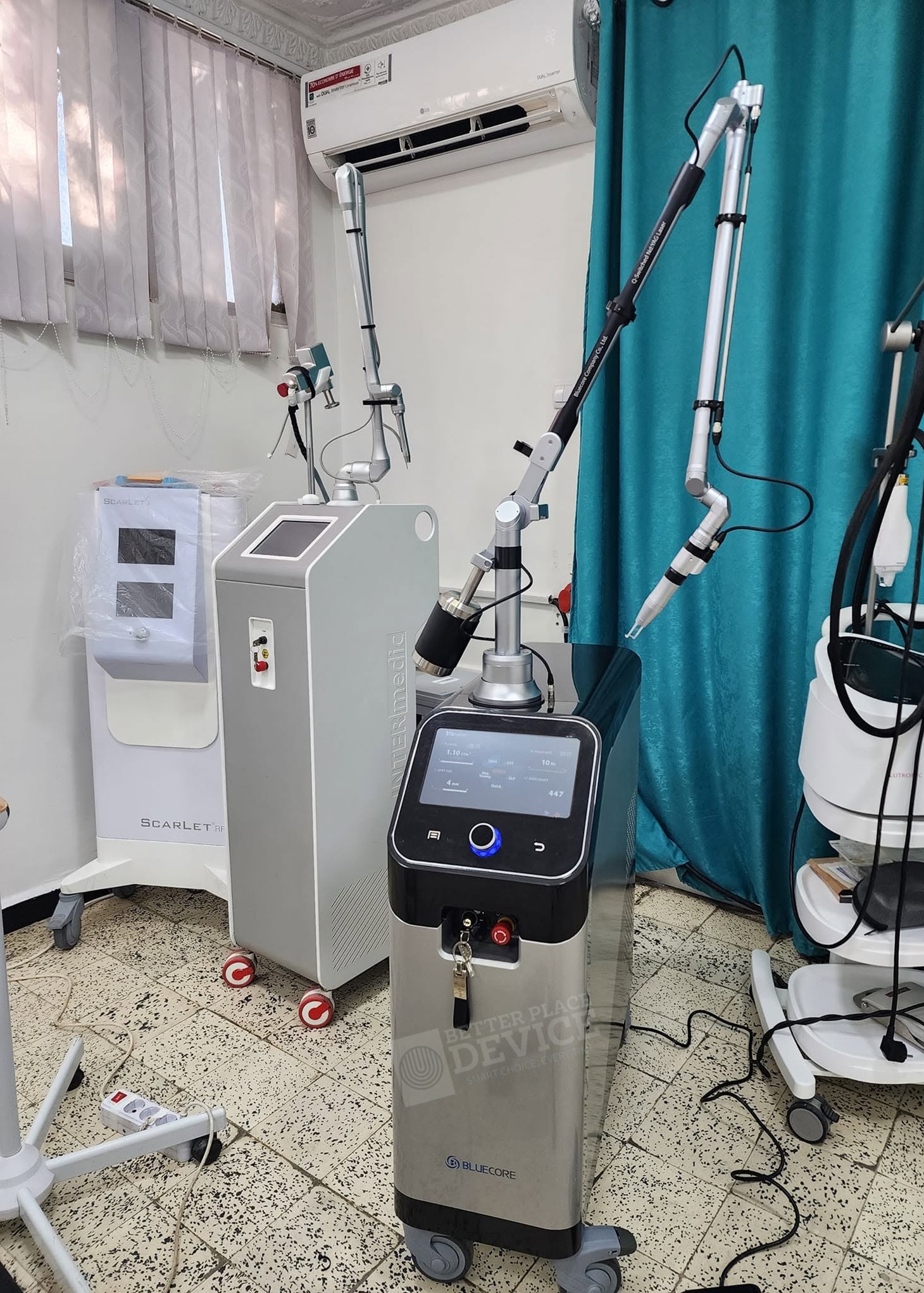 Bluecore Iris Q-switched Nd:YAG Laser System