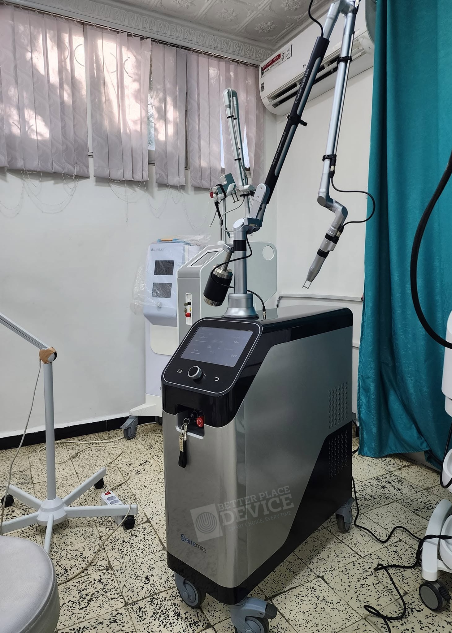 Bluecore Iris Q-switched Nd:YAG Laser System