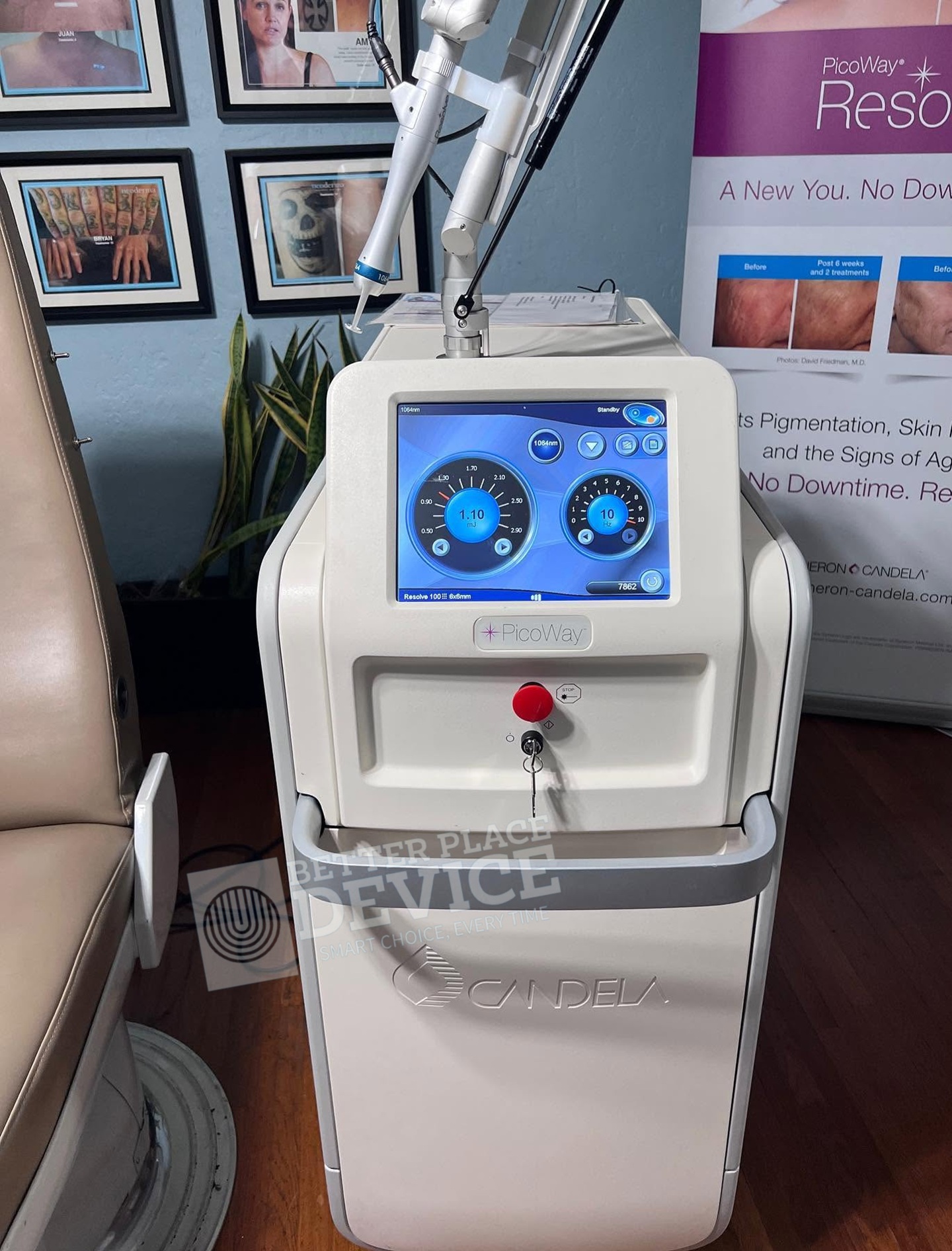 Candela PicoWay Tattoo Removal Device