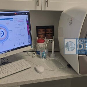 Image Pro Sunlite Skin Analysis Device